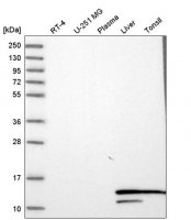 Anti-HBA1 antibody produced in rabbit HPA043780-100UL