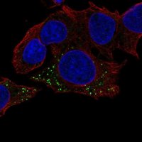 Anti-HBB antibody produced in rabbit 