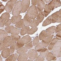 Anti-HBEGF antibody produced in rabbit 