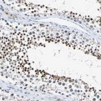 Anti-HCFC2 antibody produced in rabbit HPA006227-100UL
