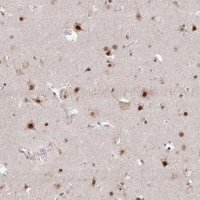 Anti-HDAC3 antibody produced in rabbit 