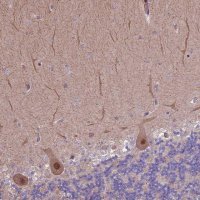 Anti-HDAC5 antibody produced in rabbit