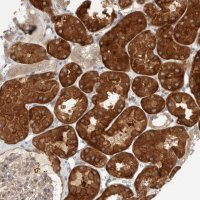 Anti-HDAC6 antibody produced in rabbit 