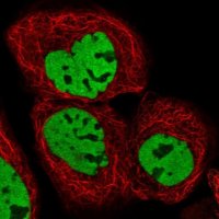 Anti-HDAC9 antibody produced in rabbit 
