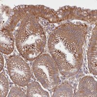 Anti-HDC antibody produced in rabbit 