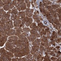 Anti-HDDC3 antibody produced in rabbit HPA040895-100UL