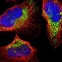 Anti-HDHD5 antibody produced in rabbit