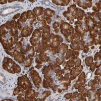 Anti-HDLBP antibody produced in rabbit 