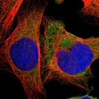 Anti-HDLBP antibody produced in rabbit 