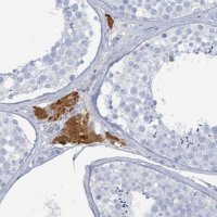 Anti-HEATR5A antibody produced in rabbit 