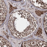 Anti-HECTD2 antibody produced in rabbit 