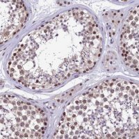 Anti-HECTD4 antibody produced in rabbit 