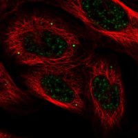 Anti-HECTD4 antibody produced in rabbit 