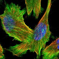 Anti-HELZ antibody produced in rabbit