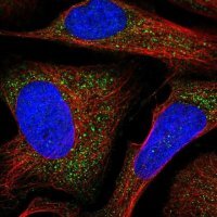 Anti-HERC2 antibody produced in rabbit 