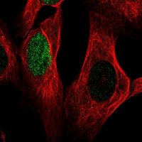 Anti-HES1 antibody produced in rabbit 