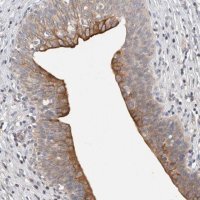 Anti-HEXDC antibody produced in rabbit HPA022834-100UL