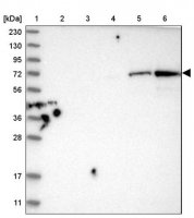 Anti-HEXDC antibody produced in rabbit HPA022834-100UL