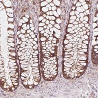 Anti-HFE antibody produced in rabbit HPA053470-100UL