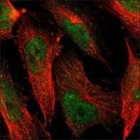 Anti-HFE2 antibody produced in rabbit HPA014472-100UL