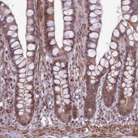 Anti-HGH1 antibody produced in rabbit 