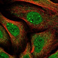 Anti-HGH1 antibody produced in rabbit 