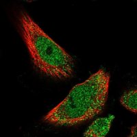 Anti-HIC1 antibody produced in rabbit 