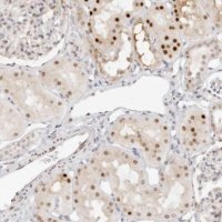 Anti-HIPK3 antibody produced in rabbit 