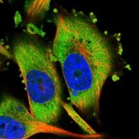 Anti-HIPK3 antibody produced in rabbit 