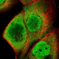 Anti-HIST1H2BC antibody produced in rabbit 