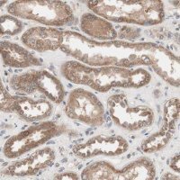 Anti-HMBS antibody produced in rabbit