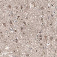 Anti-HMBS antibody produced in rabbit