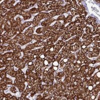 Anti-HMCN1 antibody produced in rabbit 