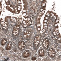 Anti-HMGCR antibody produced in rabbit 