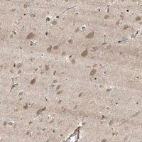Anti-HMGCR antibody produced in rabbit 