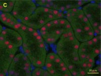Anti-HNF1B antibody produced in rabbit 