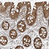 Anti-HNMT antibody produced in rabbit 