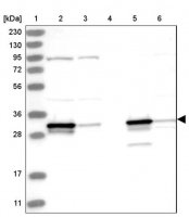 Anti-HNMT antibody produced in rabbit 