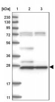 Anti-HNMT antibody produced in rabbit HPA035481-100UL
