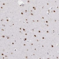 Anti-HNRNPDL antibody produced in rabbit 