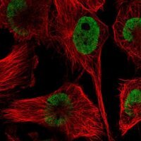 Anti-HNRNPDL antibody produced in rabbit 