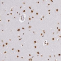Anti-HNRNPH2 antibody produced in rabbit