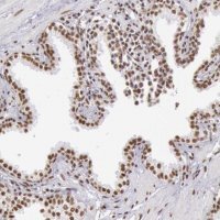 Anti-HNRNPH2 antibody produced in rabbit