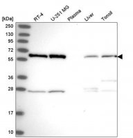 Anti-HNRNPK antibody produced in rabbit HPA044105-100UL