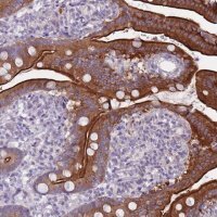 Anti-HOOK2 antibody produced in rabbit
