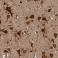 Anti-HOOK3 antibody produced in rabbit 
