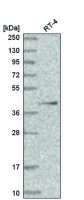 Anti-HOXA13 antibody produced in rabbit HPA046098-100UL