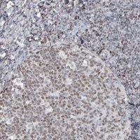 Anti-HOXA3 antibody produced in rabbit 
