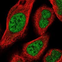 Anti-HOXA3 antibody produced in rabbit 