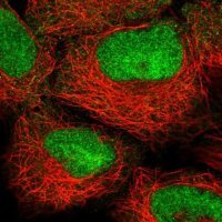 Anti-HOXB2 antibody produced in rabbit HPA047857-100UL